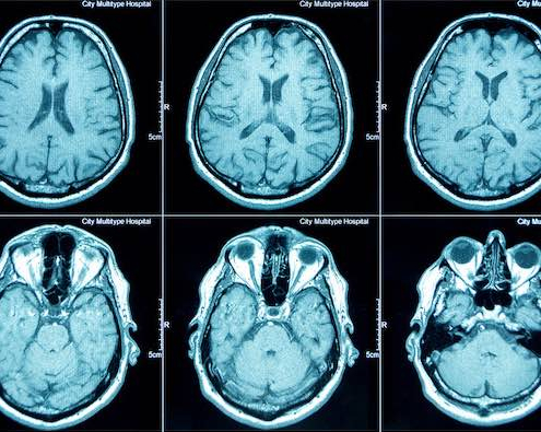 Brain Scan
