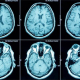Brain Scan