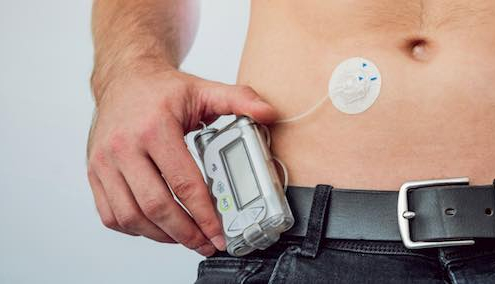 Wearable Pump