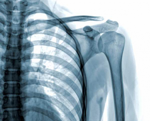 Skeleton X-Ray