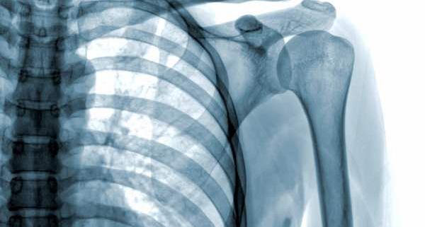 Skeleton X-Ray